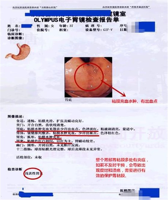 胃胀检验报告