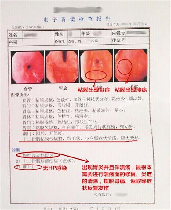 胃痛检验报告