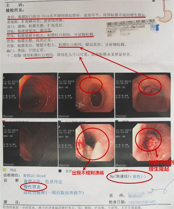 胃热检验报告