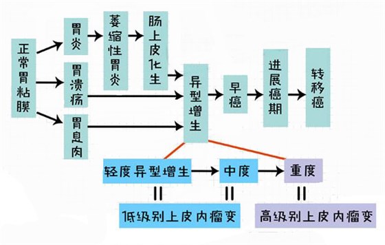 胃癌 胃粘膜病变过程0