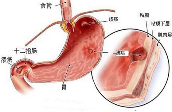 胃粘膜结构