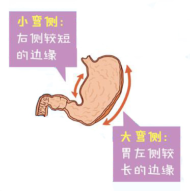 胃小弯角切迹图片