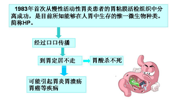 幽门螺旋杆菌